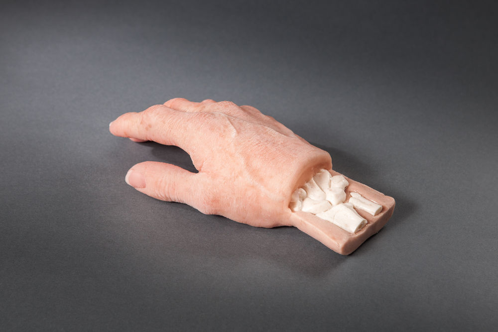 Handprothese aus Silikon mit sichtbaren Handgelenkknochen